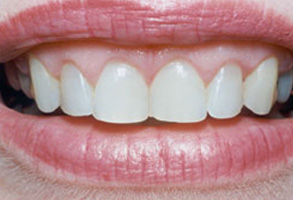 Norwalk CA Cosmetic Dentist