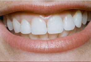Cosmetic Dental Office Norwalk CA