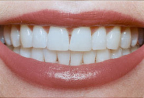 Norwalk CA Cosmetic Dentist