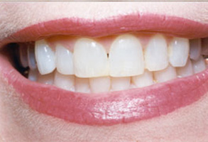 Norwalk CA Cosmetic Dentist