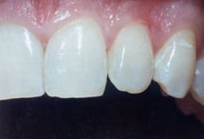 Dental Office in Norwalk CA