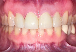 Norwalk Dental Center | Oral Cancer Screening, Pediatric Dentistry and Root Canals