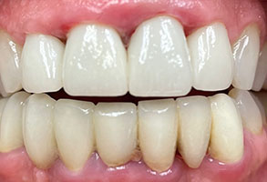 Norwalk Dental Center | Digital Radiography, Sports Mouthguards and Dental Fillings