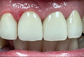 Norwalk Dental Center | TMJ Disorders, Digital Radiography and Dentures