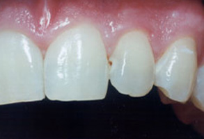 Cosmetic Dental Office Norwalk CA