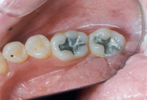 Dentist in Norwalk CA