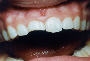 Dentist n Norwalk CA