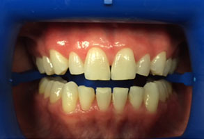 Norwalk Dental Center | Cosmetic Dentistry, Teeth Whitening and Emergency Treatment