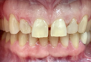 Norwalk Dental Center | Cosmetic Dentistry, TMJ Disorders and Digital Radiography