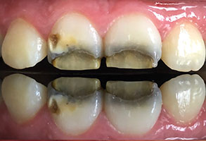 Norwalk Dental Center | Periodontal Treatment, Implant Dentistry and Cosmetic Dentistry