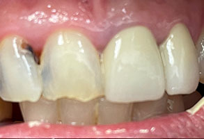 Norwalk Dental Center | Oral Exams, Night Guards and Dentures