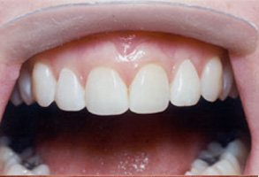 Cosmetic Dental Office Norwalk CA