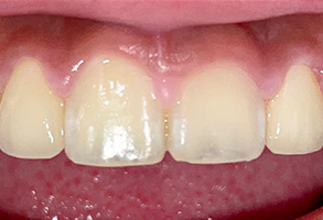 Norwalk Dental Center | Periodontal Treatment, Digital Radiography and Orthodontics