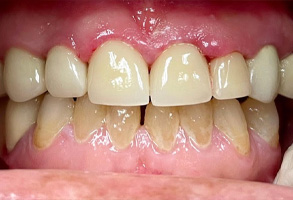 Norwalk Dental Center | Pediatric Dentistry, Cosmetic Dentistry and Night Guards