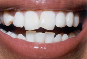 Dentist in Norwalk CA