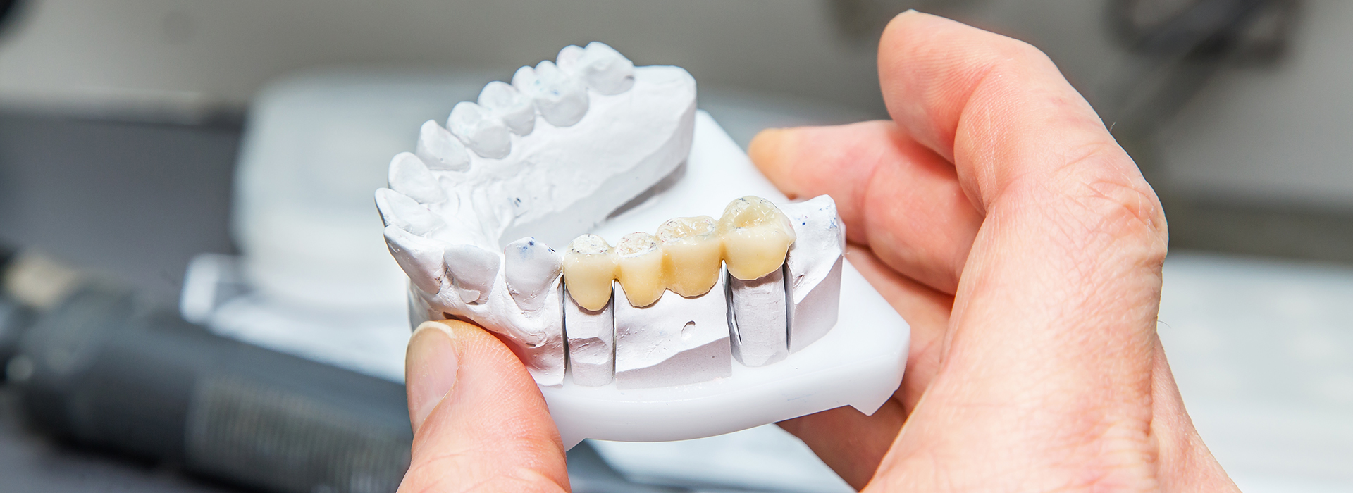 Norwalk Dental Center | Implant Dentistry, Digital Radiography and Dental Cleanings